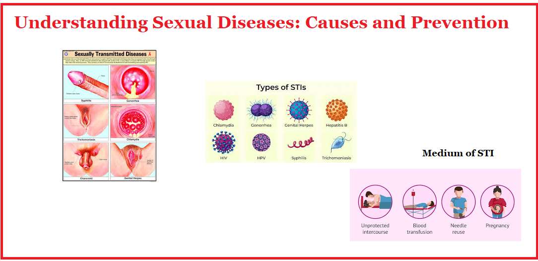 Causes and prevention of STI Sexual diseases